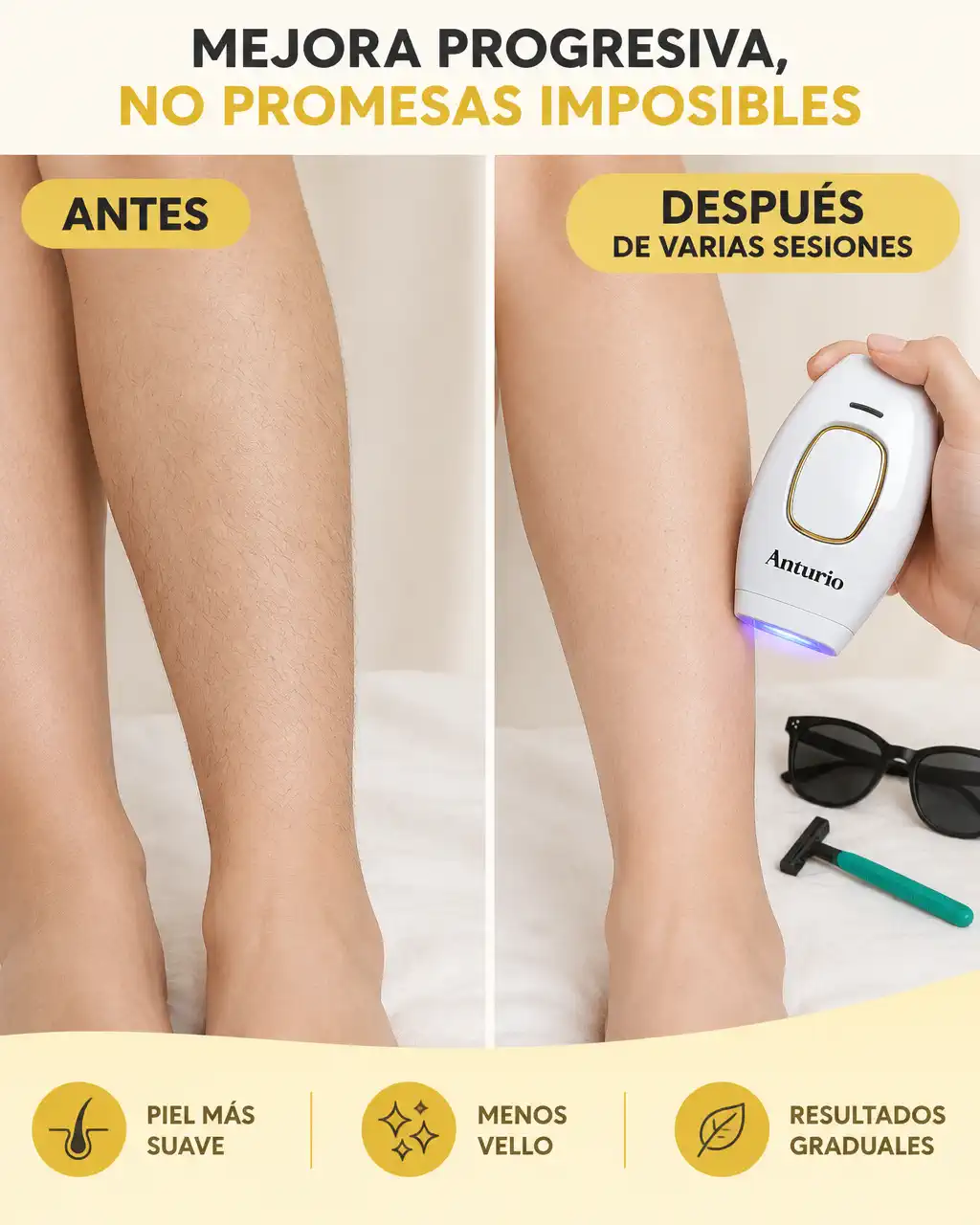 DEPILADORA IPL